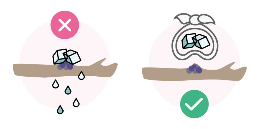 Правильное накладывание льда Правильное накладывание льда