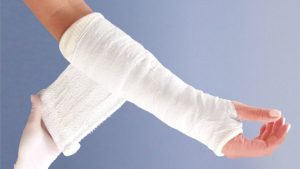 Наложение гипсовой повязки