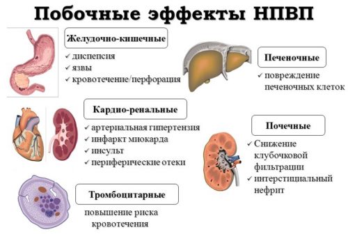 Побочные эффекты НПВС