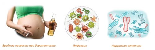 Причины хондродистрофии Причины хондродистрофии