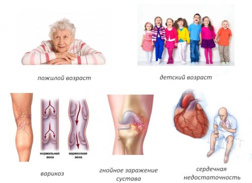 Противопоказания для артродеза