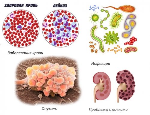 Противопоказания для плазмолифтинга Противопоказания для плазмолифтинга