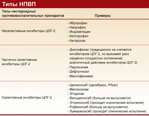 Типы НПВС