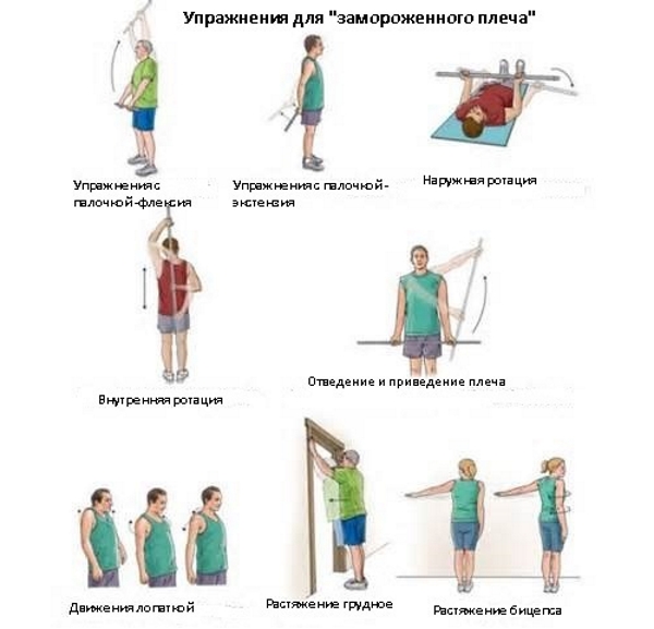Упражнения при замороженном плече
