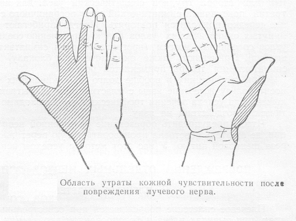 Утрата чувствительности кисти Утрата чувствительности кисти