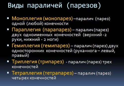 Виды парезов