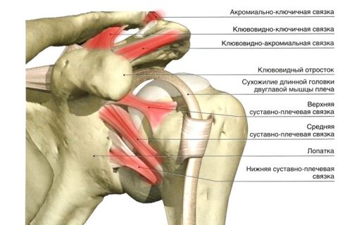 Воспаление связок плеча Воспаление связок плеча