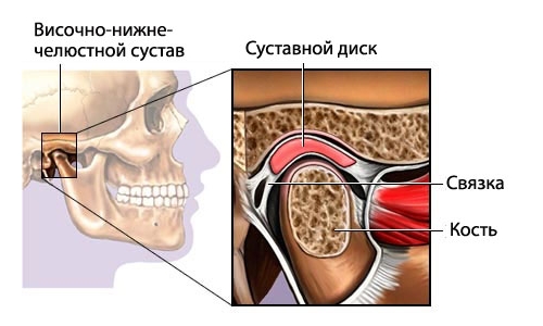 Воспаление височно-челюстного сустава