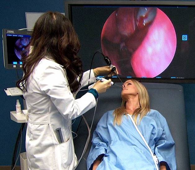 Эндоскопическое удаление полипов в носу шейвером