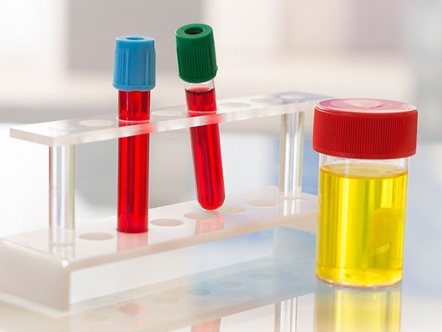 Анализ крови и мочи