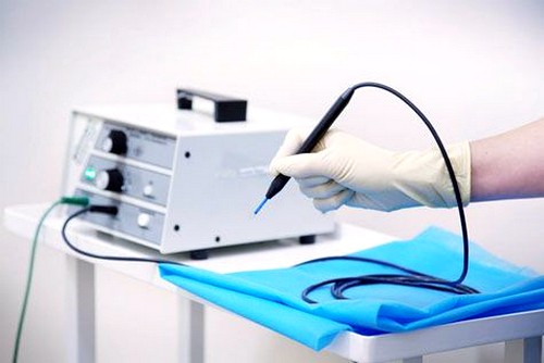 Электрическая коагуляция