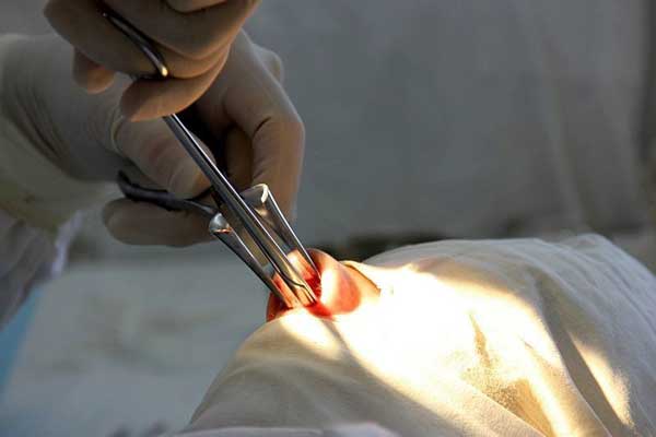 Полипотомия