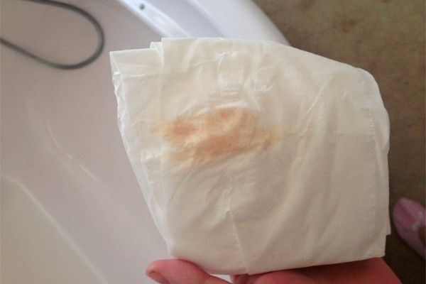 Выделения розового цвета