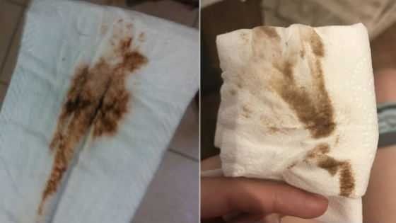 Мажущие выделения