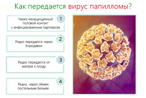 Способы заражения ВПЧ Способы заражения ВПЧ