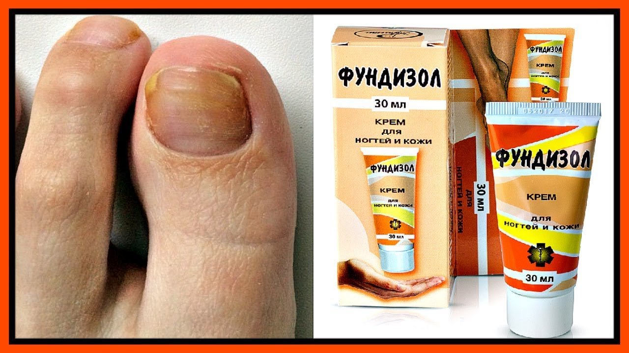 Фармакологические свойства препарата Фундизол Фармакологические свойства препарата Фундизол